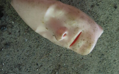 Dlaczego Warto Zrobić Peeling Chemiczny Jesienią